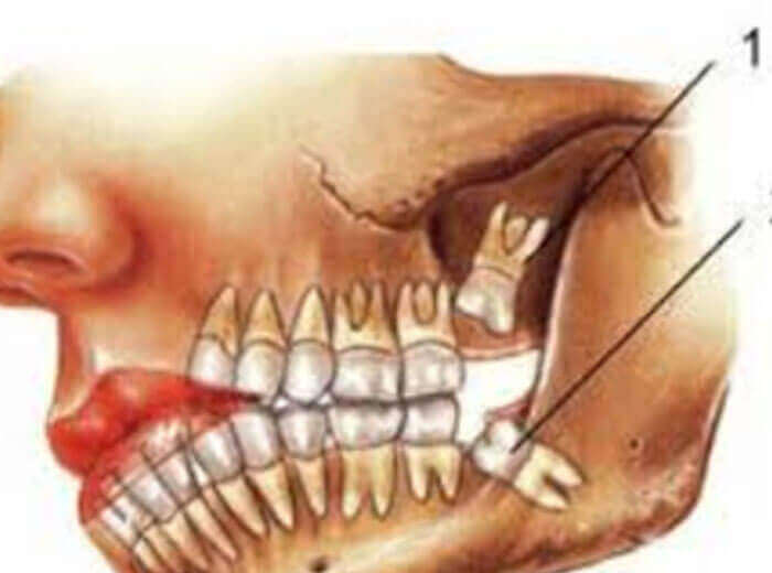 Dental treatment in ernakulam
