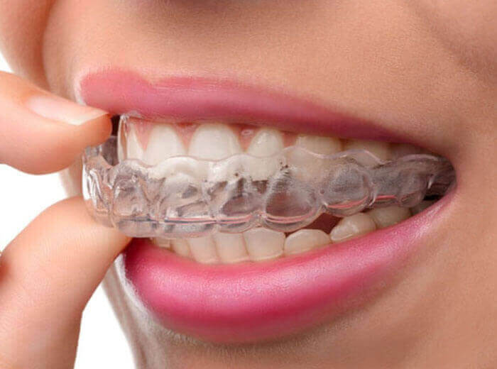 Dental clinic services in ernakulam
