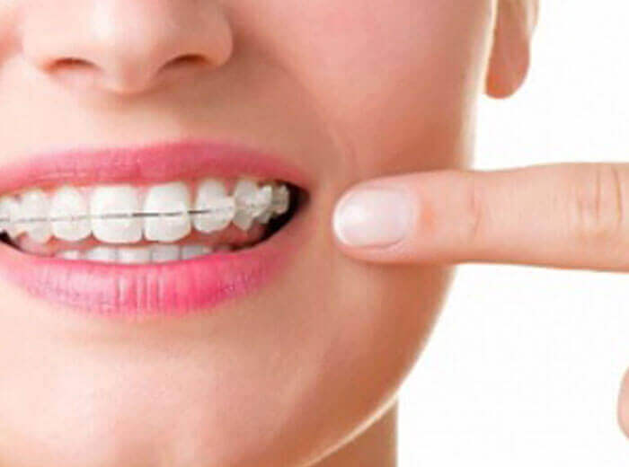 Dental treatment in kolenchery