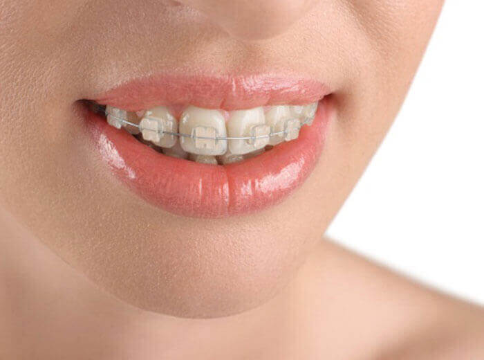 care dental in kolenchery